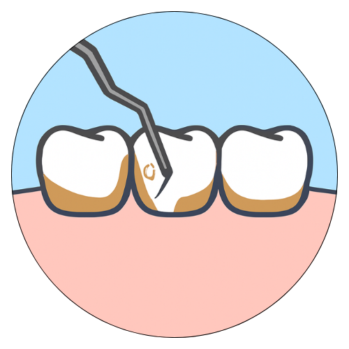 Scaling & Polishing Icon