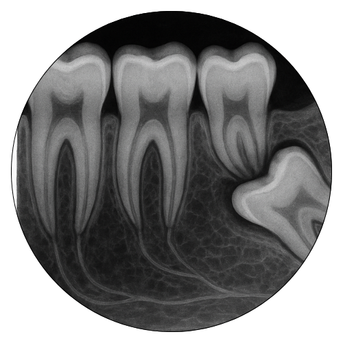 Dental X-Rays Icon