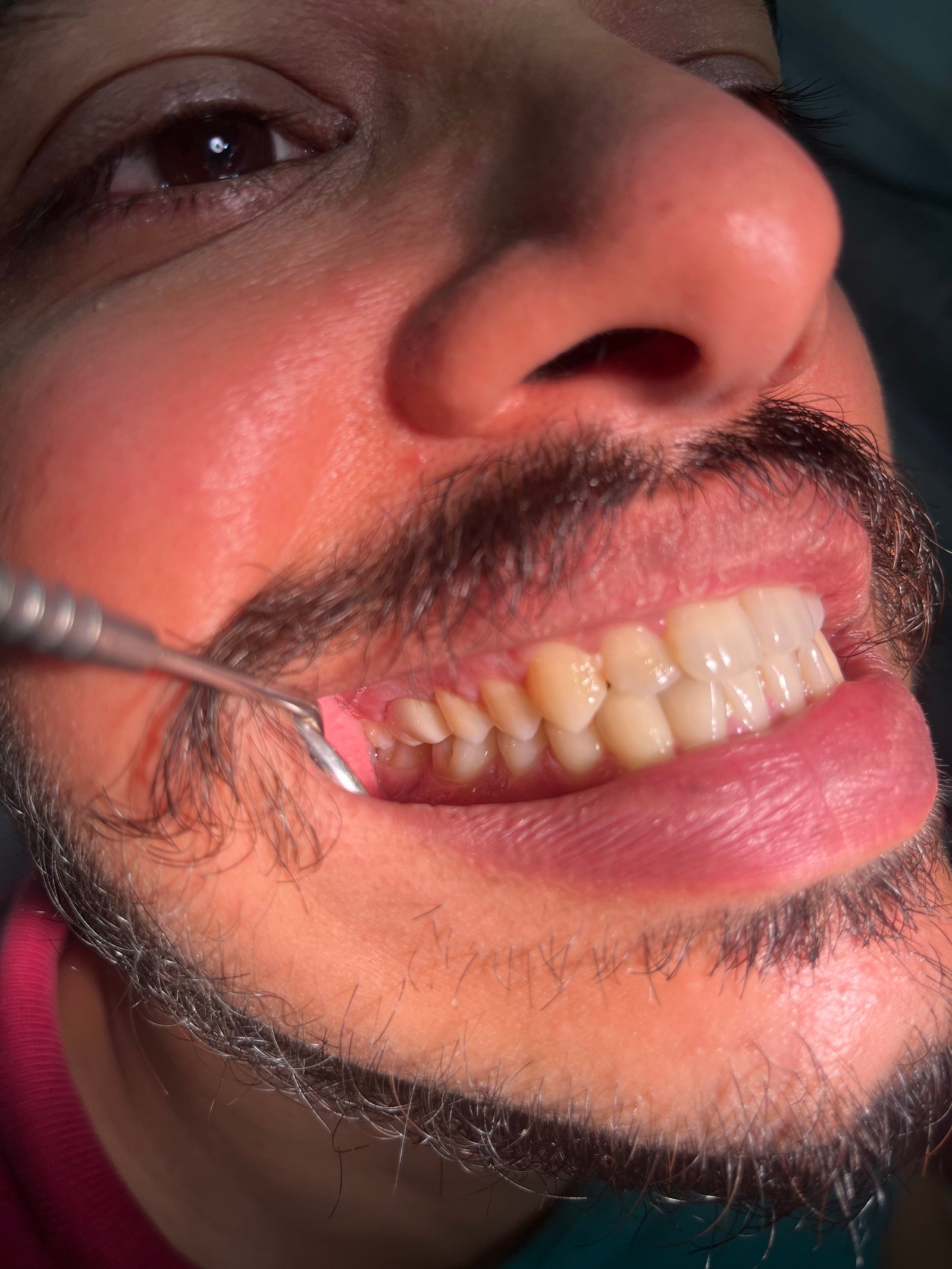 Dental Examination Closeup